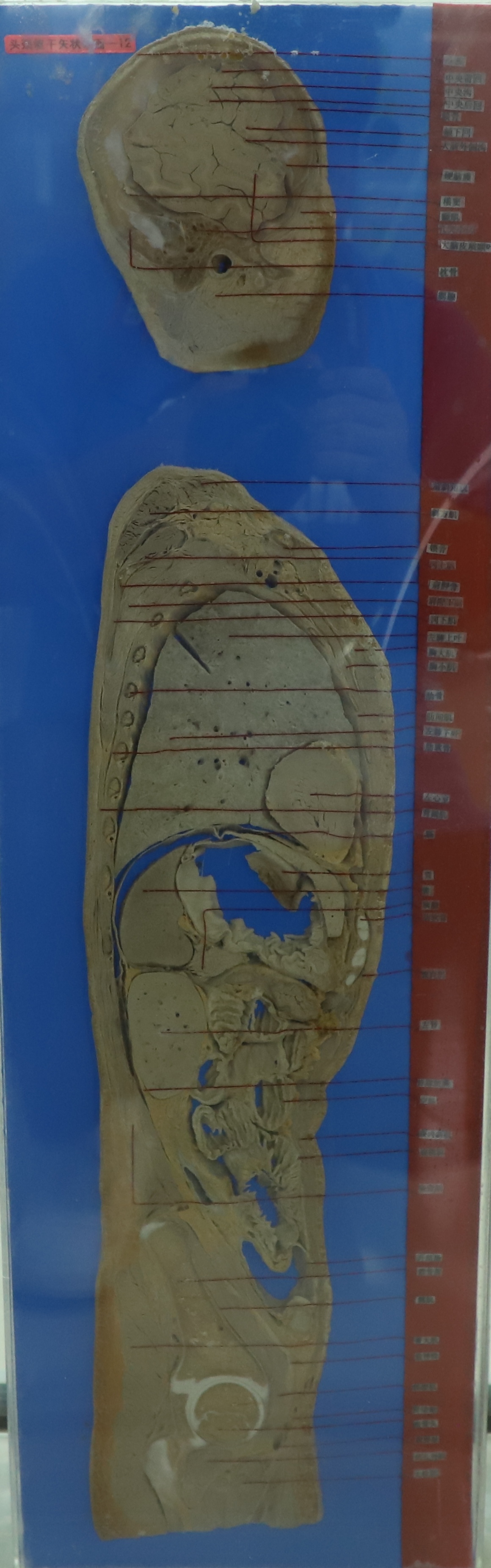 头颈躯干矢状断面