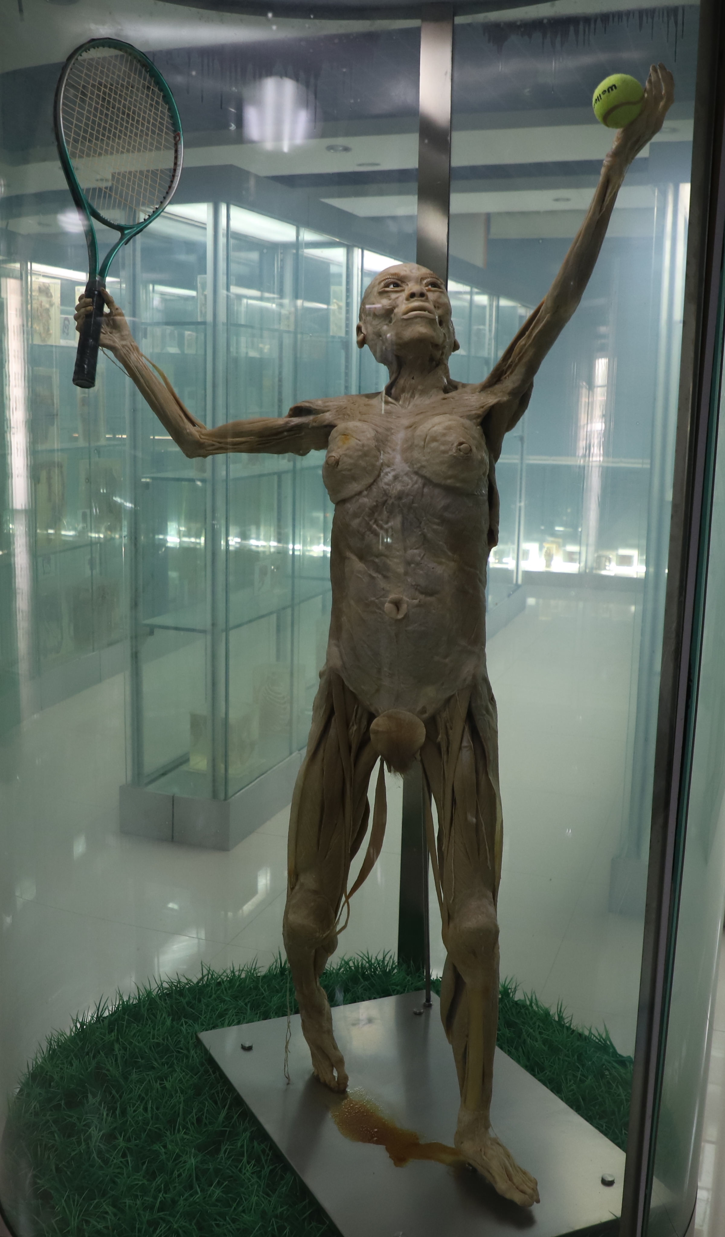 塑化标本正面观