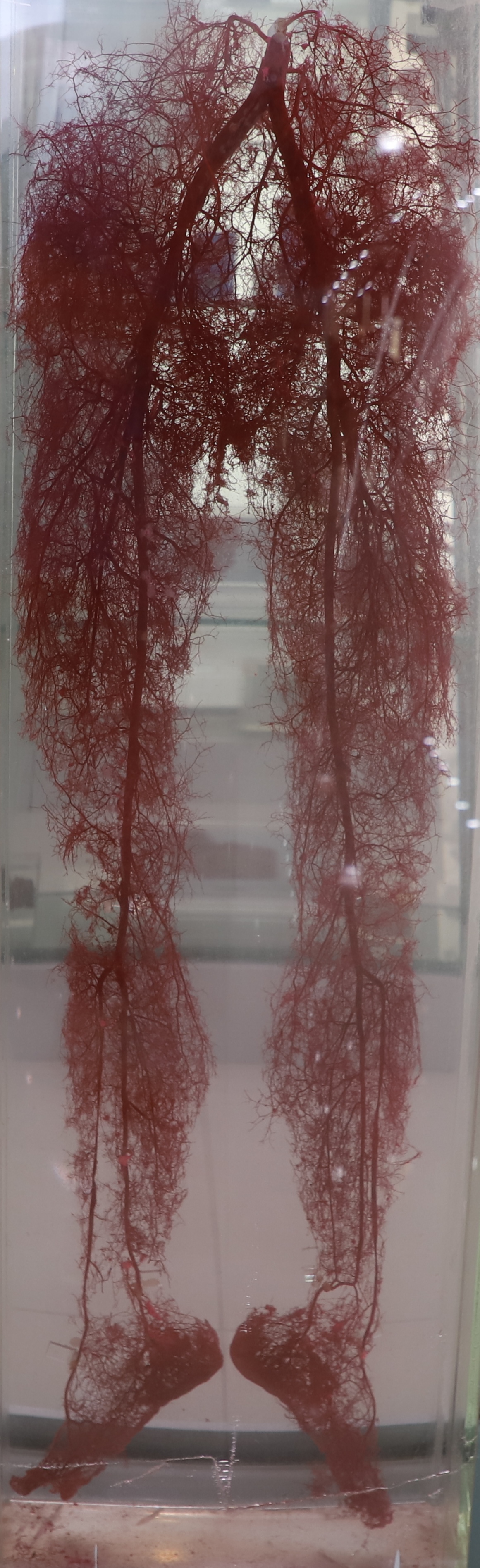 下肢血管铸型标本