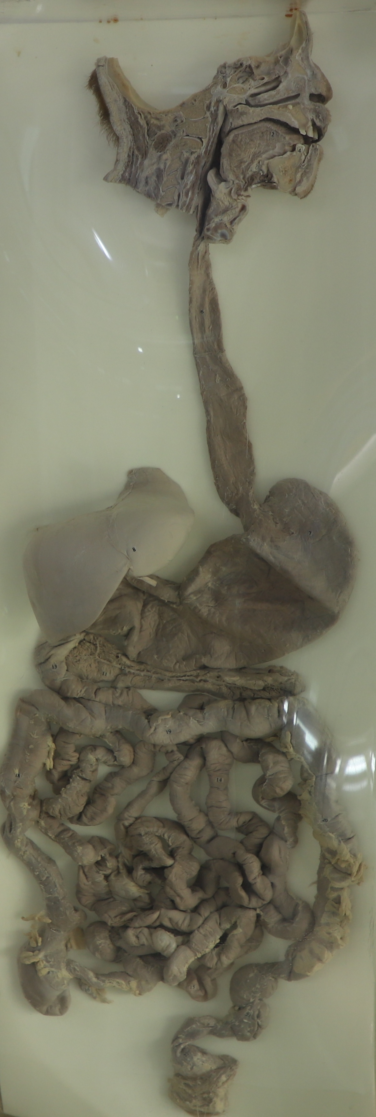 消化系统大体标本